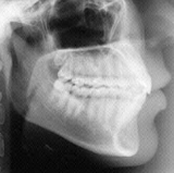 Radiologia Odontológica em Ipatinga